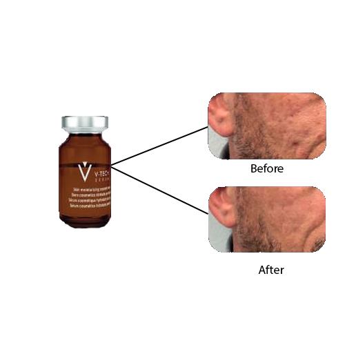 V-TECH GEL MASK