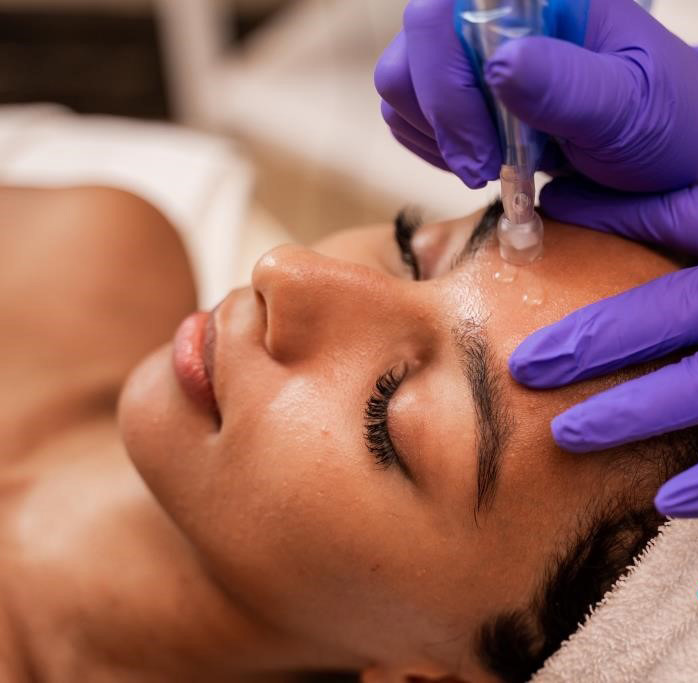 Microneedling